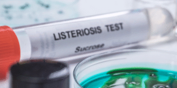 Opasna listerija u gotovim pastama: Šest preminulih, jedna žrtva iz Ilinoisa i desetine zaraženih širom Amerike