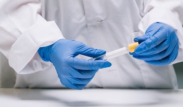 HIV kriza u Čikagu: Aktivisti tvrde da Trump-ovi rezovi guraju pacijente ka smrti